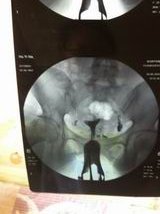 泰国试管婴儿费用预算，预算指南，省心又省力